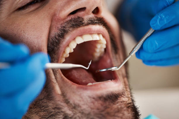 Best Emergency Dentist for Knocked-Out Tooth in Baker, LA